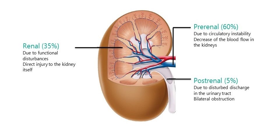 Acute Kidney Injuri