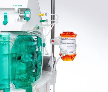 Extracorporeal CO2 Removal